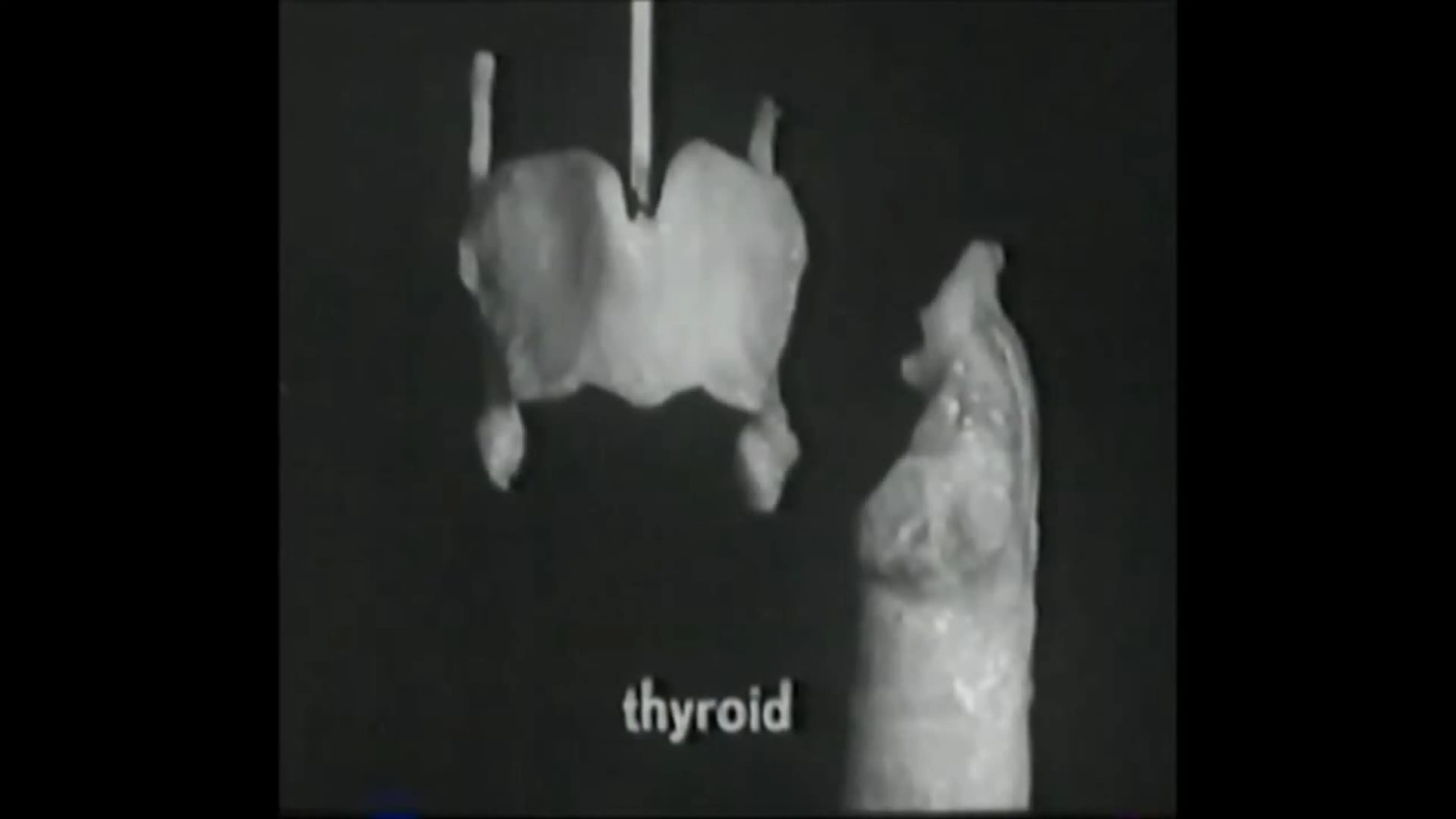 Voice Production: The Vibrating Larynx backdrop